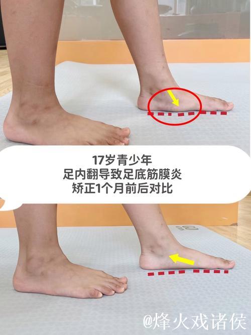 加福德:右脚踝状况改善明显,这是我近期感觉最好的一次 加福德:右脚踝状况改善明显,这是我近期感觉最好的一次